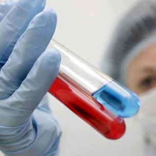 Иркутская область занимает второе место среди регионов России по заболеваемости ВИЧ
