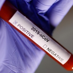 В России больше половины пациентов с коронавирусом заразились внутри страны