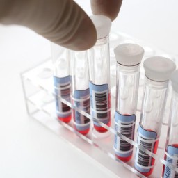 Оперштаб: лаборатория Иркутского областного СПИД-Центра начала делать тесты на коронавирус