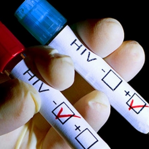Двойной рост числа желающих пройти тест на ВИЧ зафиксирован в Иркутской области