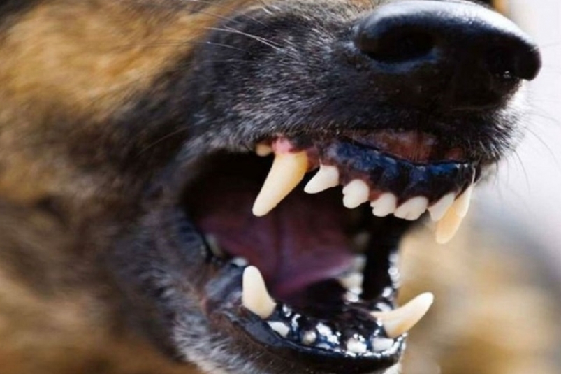 Покусанному бродячей собакой 9-ленему мальчику выплатят 50 тысяч рублей в Усолье-Сибирском