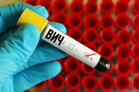 В Иркутске у трех постоянных доноров крови нашли ВИЧ