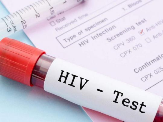 Медики установили точное число  ВИЧ-инфицированных в Приангарье