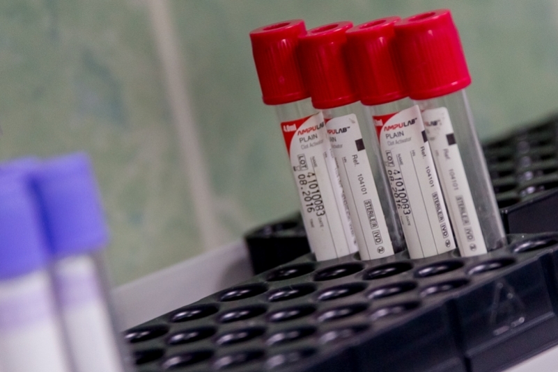 Роспотребнадзор сообщил, сколько стоит тест на коронавирус на дому