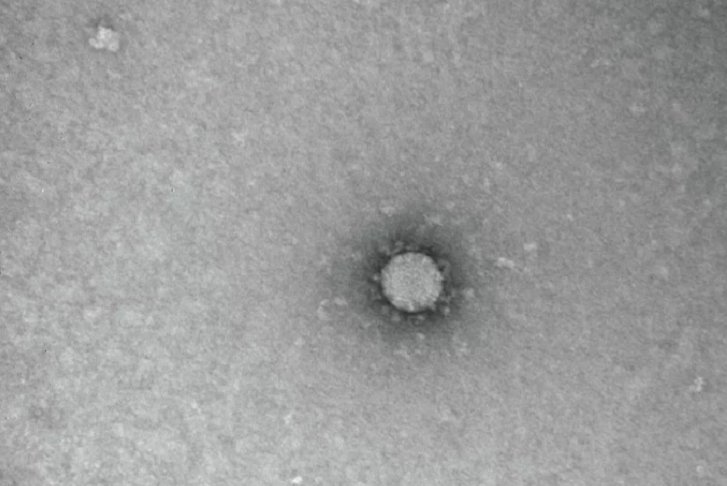 Ученые выяснили губительную температуру для коронавируса