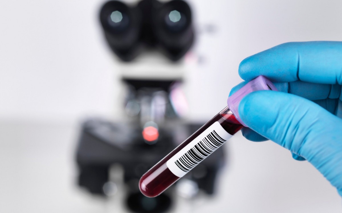 Иркутская область входит в первую десятку в стране по количеству проведенных тестов на коронавирусную инфекцию