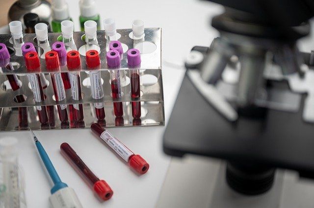В июне в Иркутской области начнётся тестирование на антитела к коронавирусу