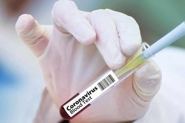 6635 жителей Иркутской области заболели коронавирусом