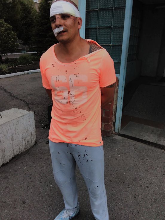 Штаб Навального в Иркутске заявил об избиении сына арендодателя помещения