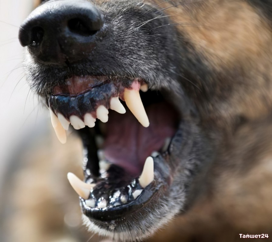 13 швов и сломанный нос: в Чунском районе бродячая собака вцепилась в лицо школьницы