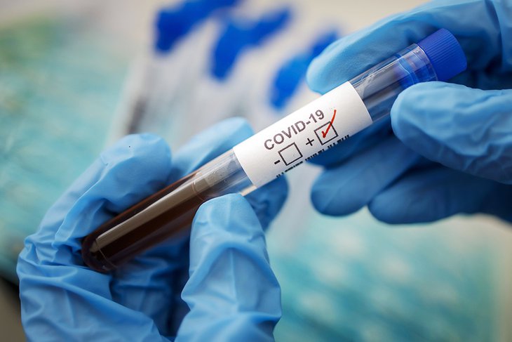 123 новых случая коронавируса выявили за сутки в Иркутской области