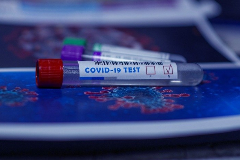 Как проверить себя на коронавирус – рекомендации инфекциониста