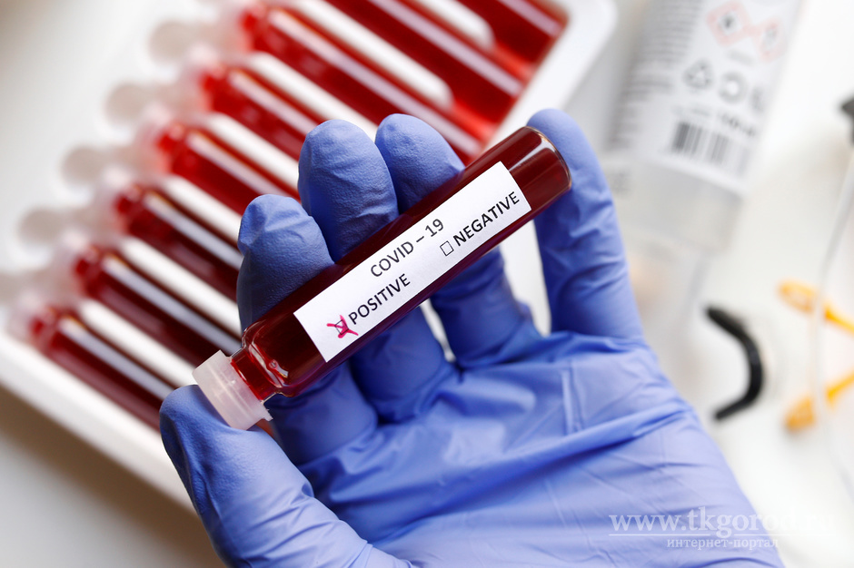 В Приангарье за сутки зафиксировано наибольшее число смертей пациентов с коронавирусом за всё время эпидемии