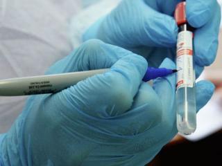 В Приангарье выздоровел еще 301 человек и 15 пациентов с коронавирусом скончались