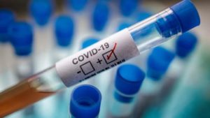 Число случаев заболевания COVID в Иркутской области превысило 32 тысячи