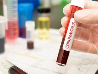 Еще 247 жителей Приангарья заболели коронавирусом