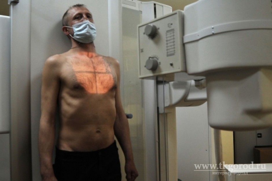 9 общежитий в Братске оказались очагами туберкулеза