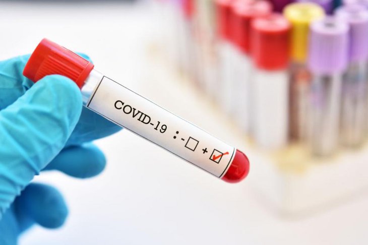 В России лаборатории обязали сократить срок выполнения тестов на COVID-19 с 48 до 24 часов