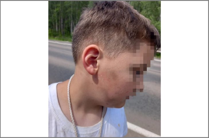 В Братске в санатории «Юбилейный» группа подростков избивала детей