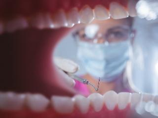 В Иркутской области стоматологи забыли инструмент во рту пациента