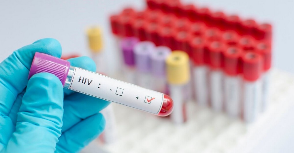 Жители Тайшета 22 сентября смогут сдать экспресс-тест на ВИЧ