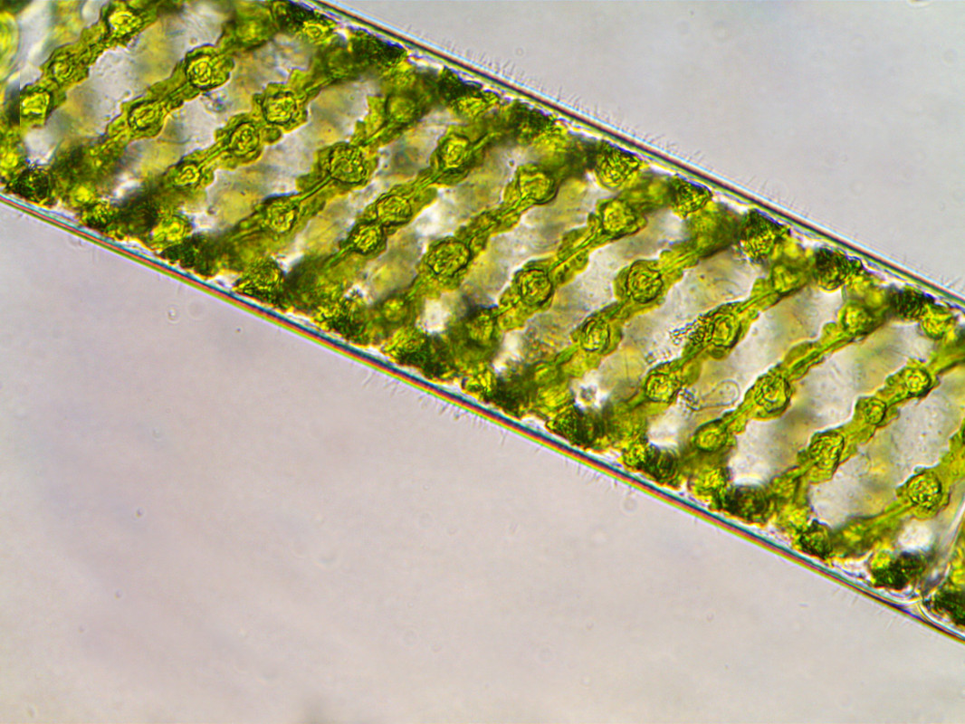 Спирогира отдел. Нитчатая водоросль спирогира. Спирогира зеленая нитчатая водоросль. Водоросли улотрикс и спирогира. Спирофирапод микроскопом.